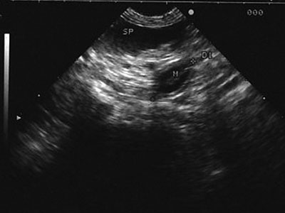 case4